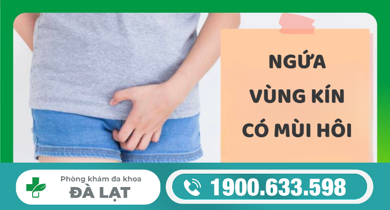 Hình ảnh minh họa